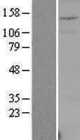Human USPL1 Protein (Over-Expression Lysate Myc-DDK (Flag))