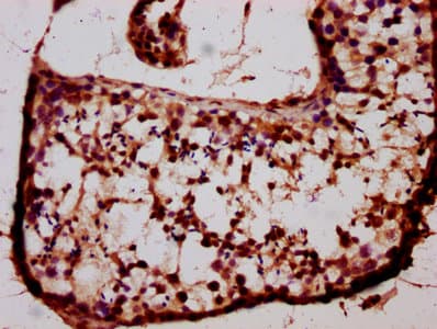 Polyclonal Rabbit anti-Human BARHL1 Antibody (IHC, WB)