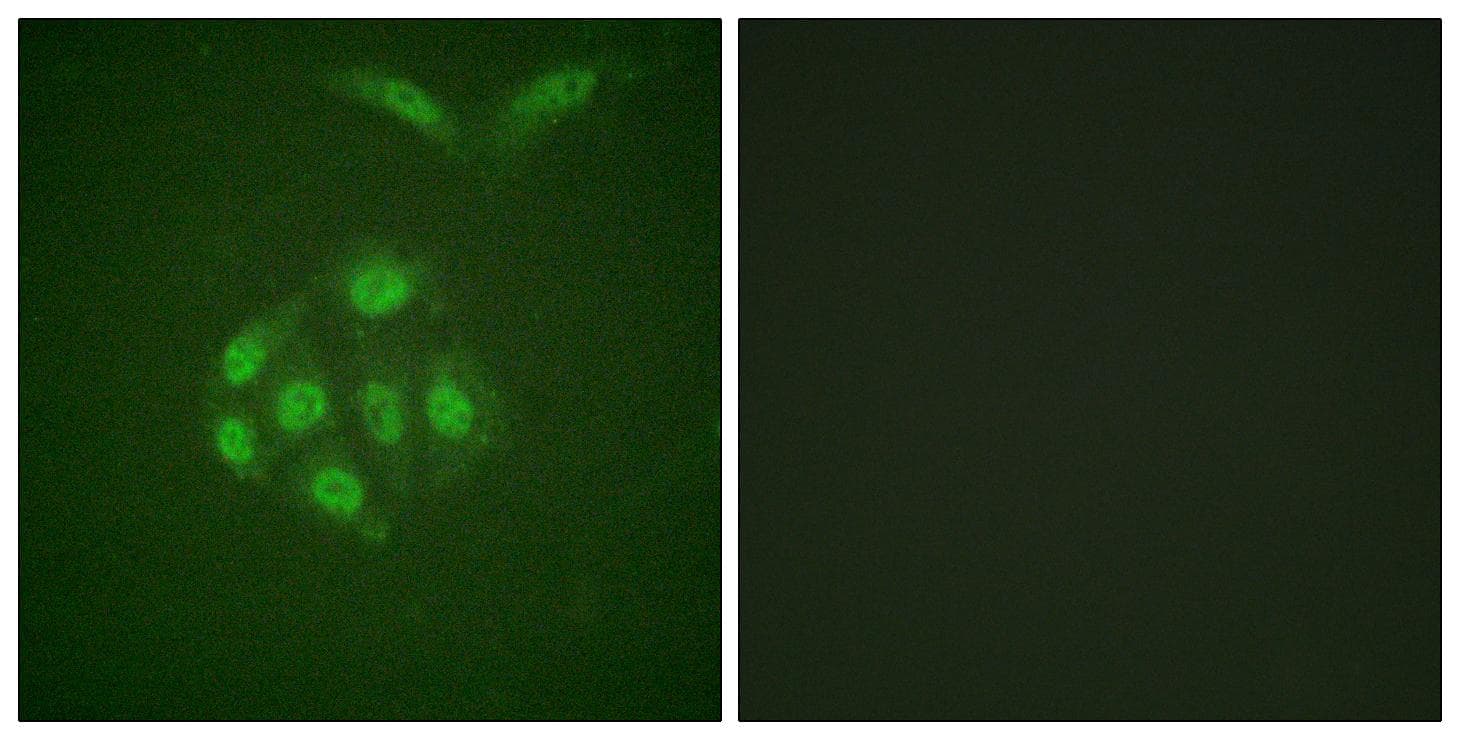 BIRC5 / Survivin Antibody (phospho-Thr117)