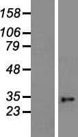 GDAP1 Protein (Over-Expression Lysate Myc-DDK (Flag))