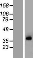 KCNN3 / SK3 Protein (Over-Expression Lysate Myc-DDK (Flag))