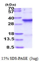 Human CDK1 / CDC2 Protein (Recombinant His)