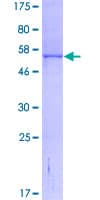 Human NQO1 Protein (Recombinant GST)