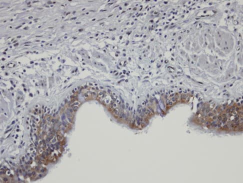 SHKBP1 Antibody (aa162-477)