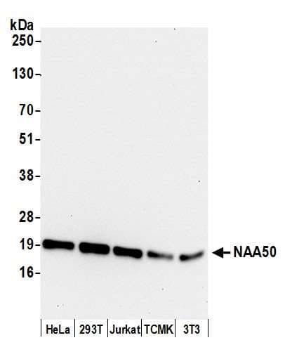 NAA50 / NAT13 / SAN Antibody (aa119-169)