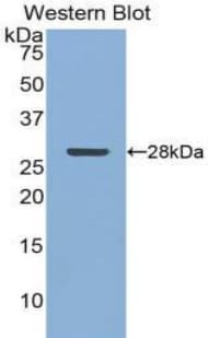 CLU / Clusterin Antibody (aa228-449, APC)