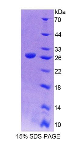 Human CDH15 / M Cadherin Protein (Recombinant 10His, N-terminus)