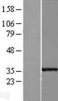 SLC25A36 Protein (Over-Expression Lysate Myc-DDK (Flag))