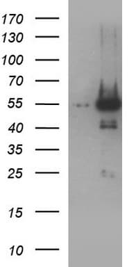 ANKMY2 Antibody (clone OTI1C12)