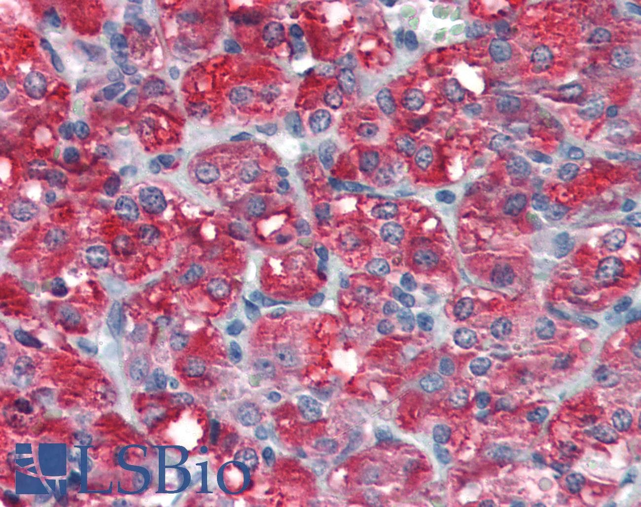 IHC-plus™ SKP2 Antibody (aa221-425)