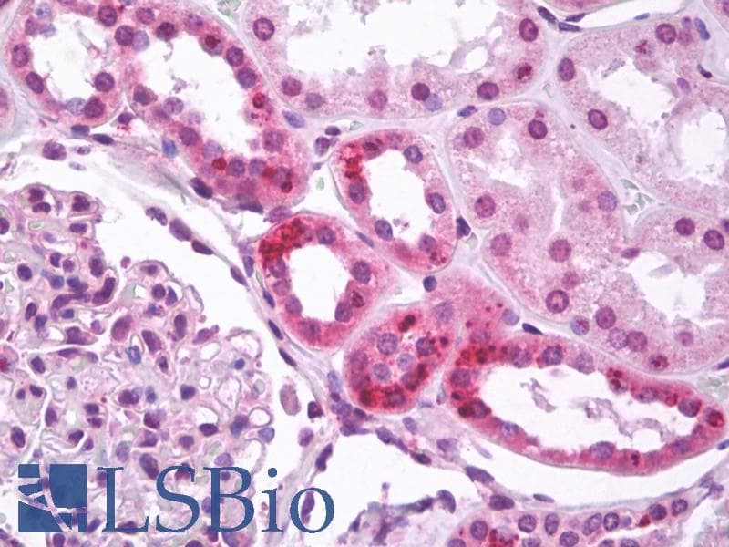 IHC-plus™ Polyclonal Rabbit anti-Human MBD2 Antibody (Internal, IHC, WB)