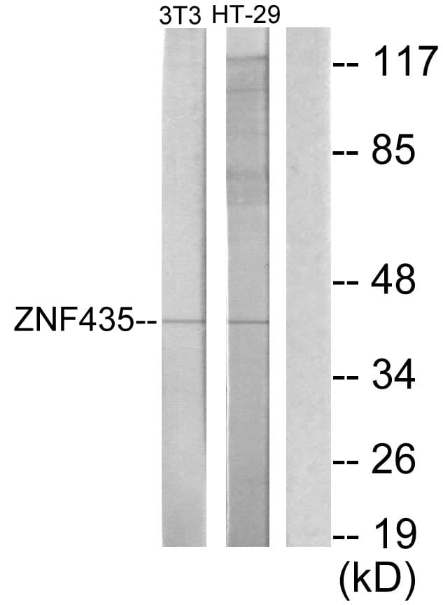 ZNF435 / ZSCAN16 Antibody (aa191-240)