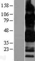 Human CD32B Protein (Over-Expression Lysate Myc-DDK (Flag))