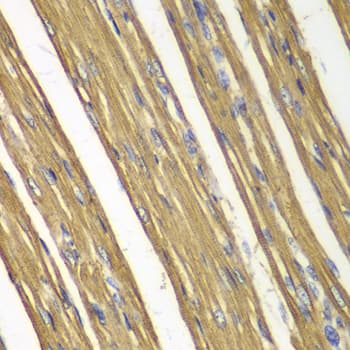 Polyclonal Rabbit anti-Human CASP7 / Caspase 7 Antibody (IHC, WB)