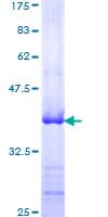 Human ADAMTS4 Protein (Recombinant GST, N-terminus)