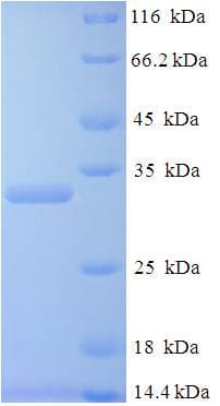 Human PGF / PLGF Protein (Recombinant His-SUMO)