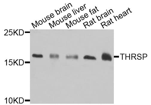 Polyclonal Rabbit anti-Human THRSP Antibody (IHC, IF, WB)
