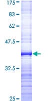 Human SMC3 / HCAP Protein (Recombinant GST, N-terminus)