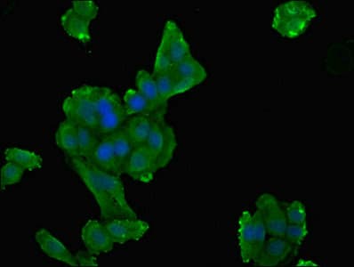 DPYS / Dihydropyrimidinase Antibody