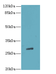 Polyclonal Rabbit anti-Human TBC1D26 Antibody (WB)