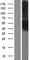 CA12 / Carbonic Anhydrase XII Protein (Over-Expression Lysate Myc-DDK (Flag))