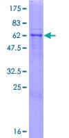 Human BGN / Biglycan Protein (Recombinant GST)