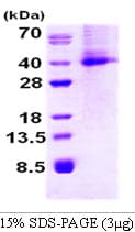 Human DKK1 Protein (Recombinant His)