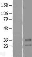 SLC39A2 / ZIP2 Protein (Over-Expression Lysate Myc-DDK (Flag))