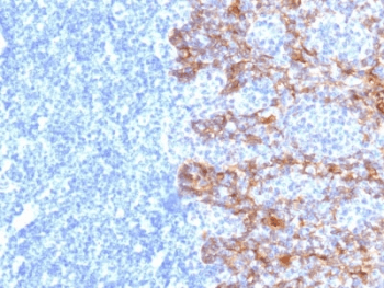 Acidic Cytokeratin Antibody (clone SPM115, Azide-free, BSA-free)