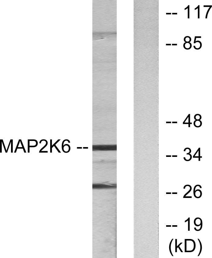 MAP2K6 / MEK6 / MKK6 Antibody