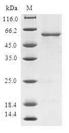 Mouse MGLL / Monoacylglycerol Lipase Protein (Recombinant 6His-SUMO, N-terminus)