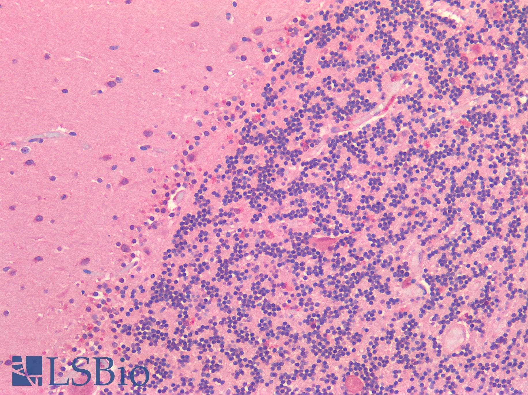 IHC-plus™ Polyclonal Rabbit anti-Human ROR1 Antibody (C-terminal, IHC)