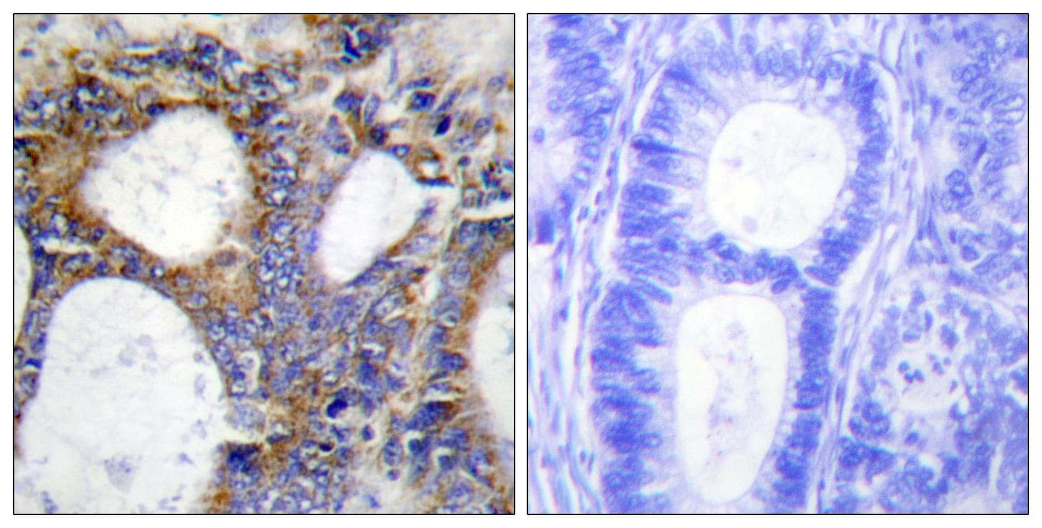 COL1A2 / Collagen I Alpha 2 Antibody