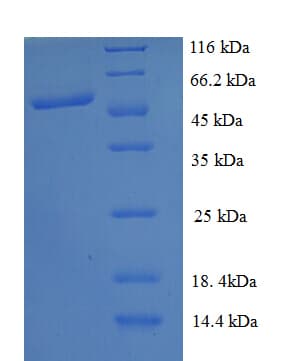 Human PICK1 Protein (Recombinant GST)