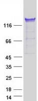 Human PUM1 Protein (Recombinant Myc-DDK (Flag))