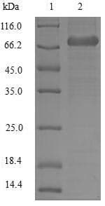Human LCP1 / L-Plastin Protein (Recombinant 10His, N-terminus)