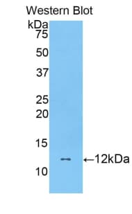 DBI / ACBD1 Antibody (aa2-87)