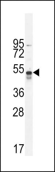 TNFRSF1A / TNFR1 Antibody (aa252-281)