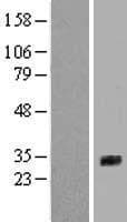SFTPA2B Protein (Over-Expression Lysate Myc-DDK (Flag))