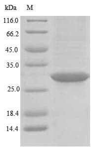 Pig Rhodopsin / RHO Protein (Recombinant GST, N-terminus)