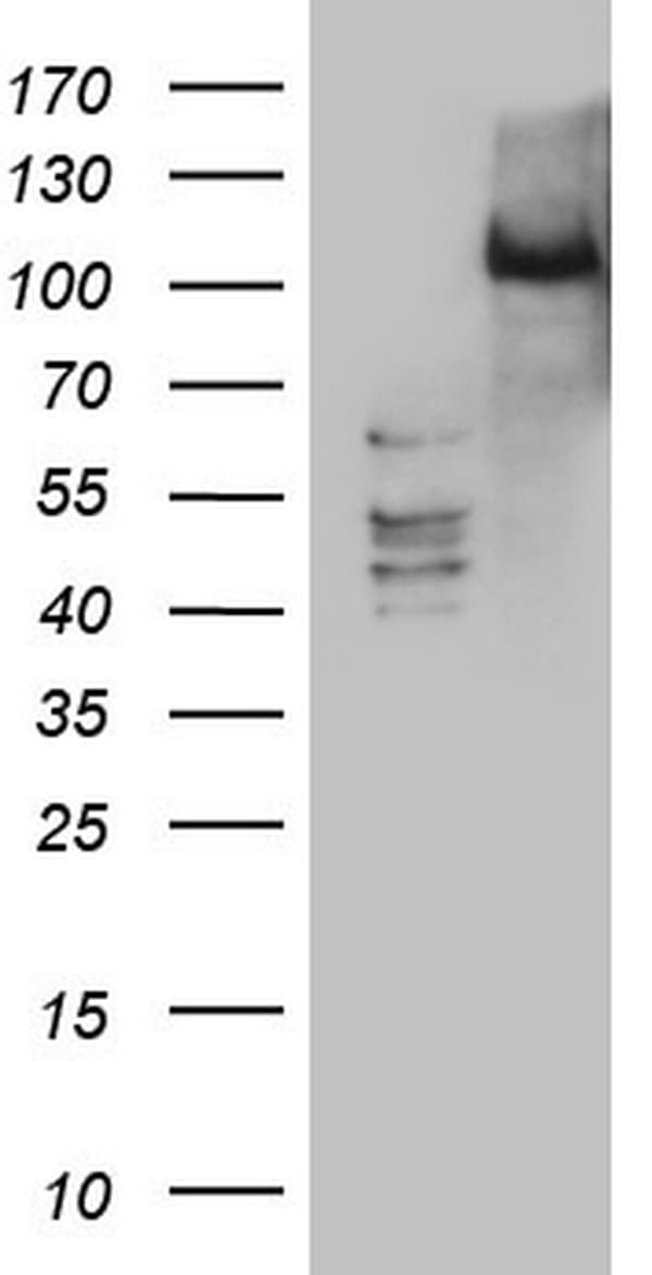 PKD3 / PRKD3 Antibody (aa300-508, clone OTI3D8)