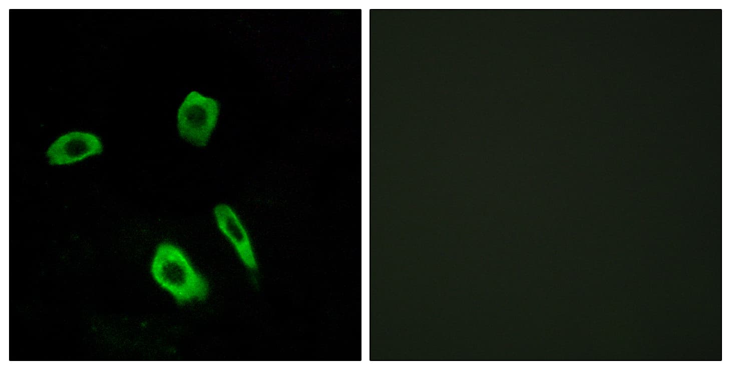LPAR3 / LPA3 / EDG7 Antibody (aa111-160)