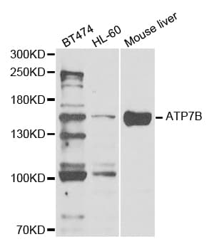 WC1 / ATP7B Antibody