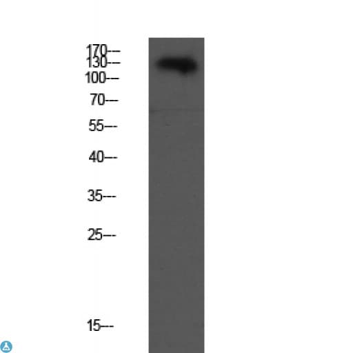 Polyclonal Rabbit anti-Human CD144 / CDH5 / VE Cadherin Antibody (WB)