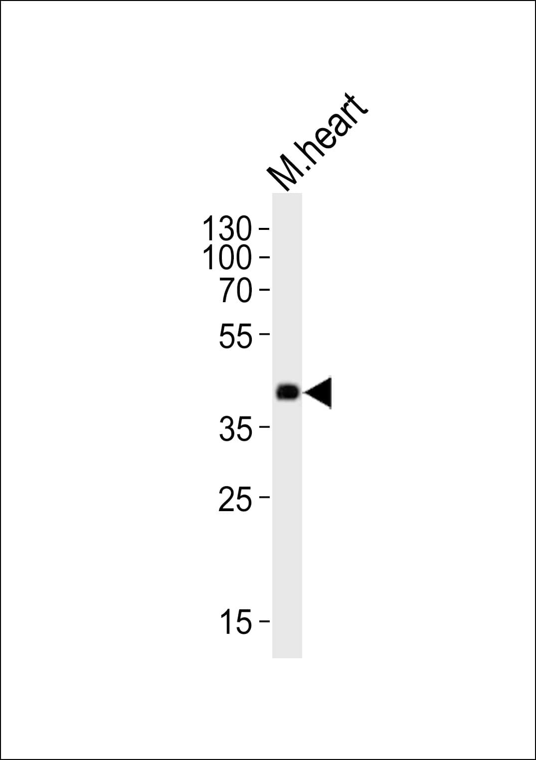 DNMT3L Antibody (aa258-290)