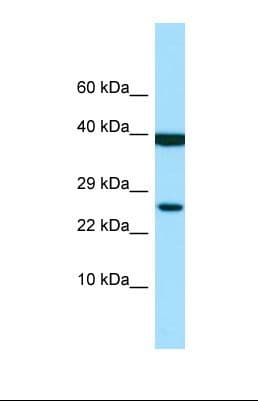 LILRA1 / LIR6 Antibody (aa151-200)