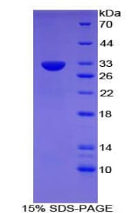 Mouse CD109 Protein (Recombinant His, N-Terminal)