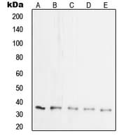Polyclonal Rabbit anti-Human SYP / Synaptophysin Antibody (Internal, IF, WB)