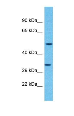 Polyclonal Rabbit anti-Human OR2F2 Antibody (C-Terminus, WB)