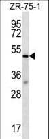 TBL2 Antibody (aa43-72)